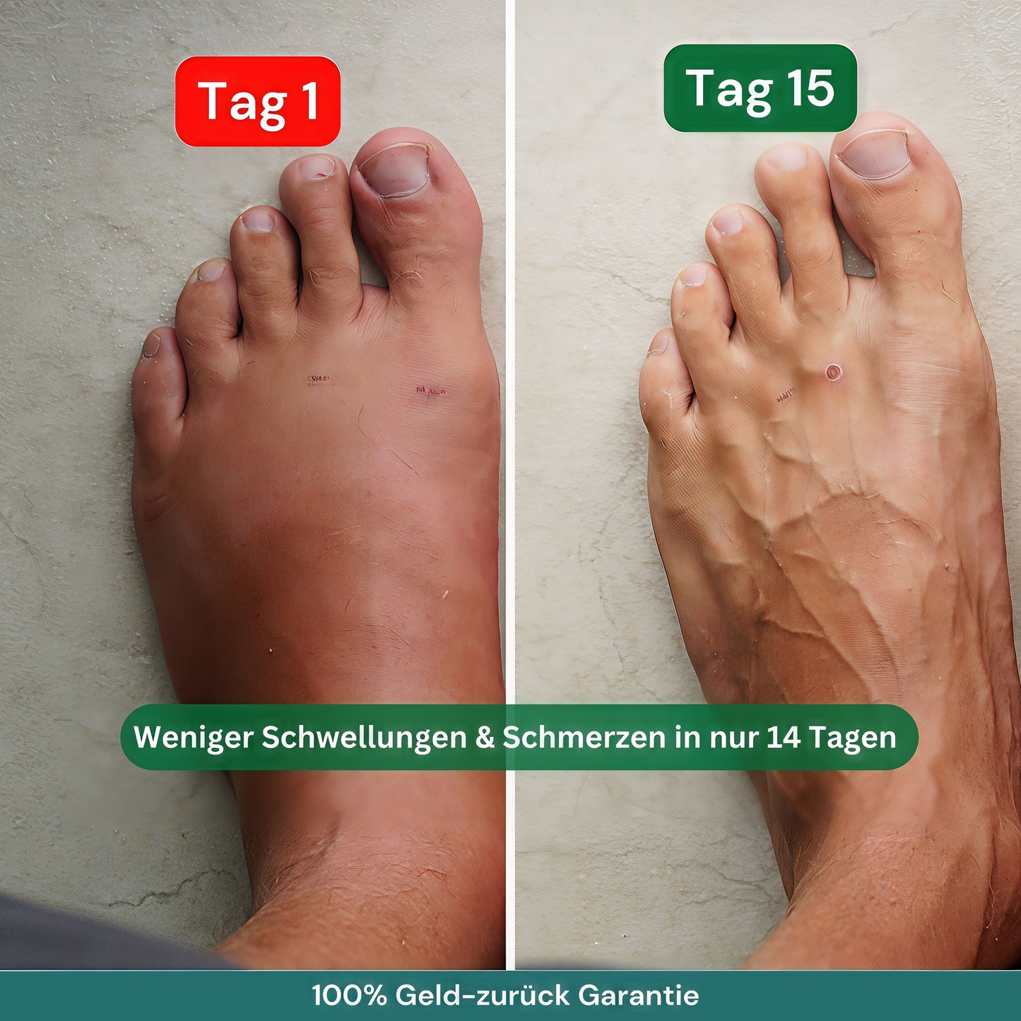 Veranine™ - Für entspannte Beine in der Schwangerschaft